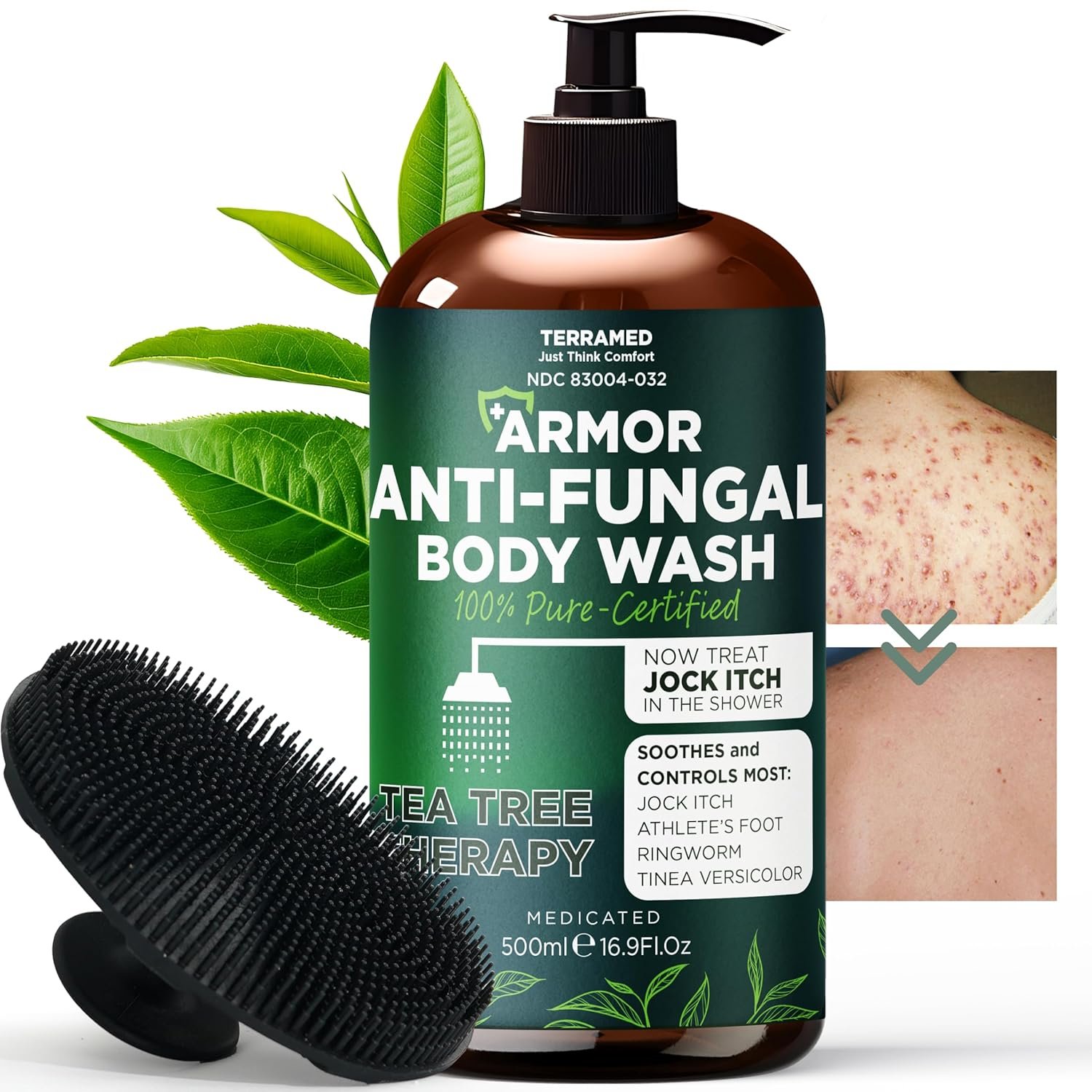 Antifungal Body Wash with Tea Tree Oil | Antifungal Soap for Back Acne,Treats Ringworm, Eczema & Jock Itch | Antifungal Body Soap For Men And Women | Includes Silicon Scrubber (16.9 oz)